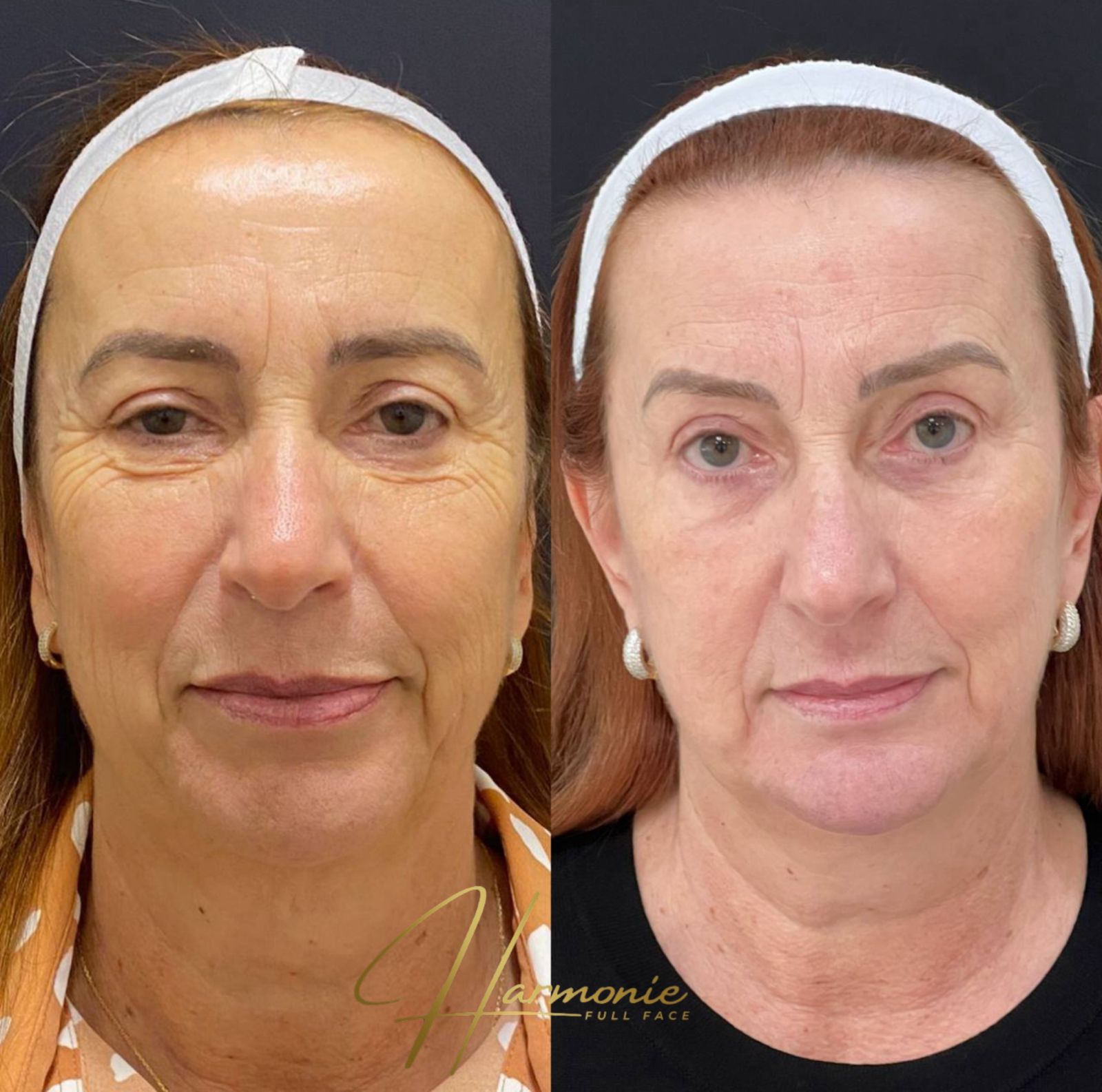 WhatsApp Image 2025-10-21 at 17.13.46_bc02d7a1